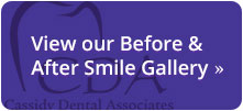 Cassidy Smile Gallery